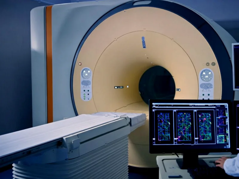 Brain's Allostatic System Mapped with 7T fMRI Breakthrough - According to Nature, researchers used 7 Tesla functional MRI to